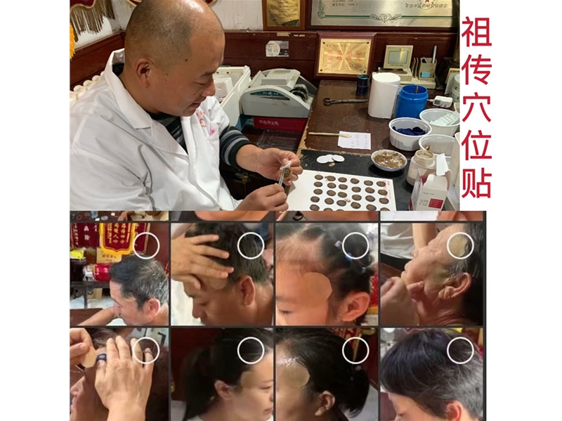 聊城顽固性头痛病研究所